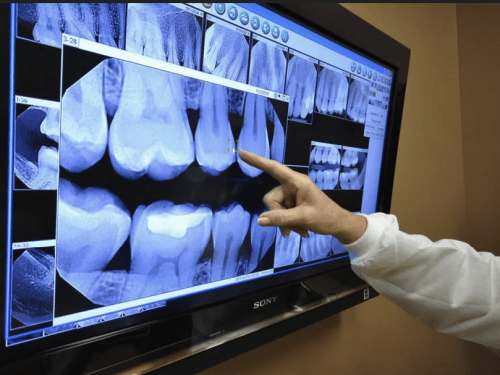 Использование рентгеновских аппаратов в стоматологии