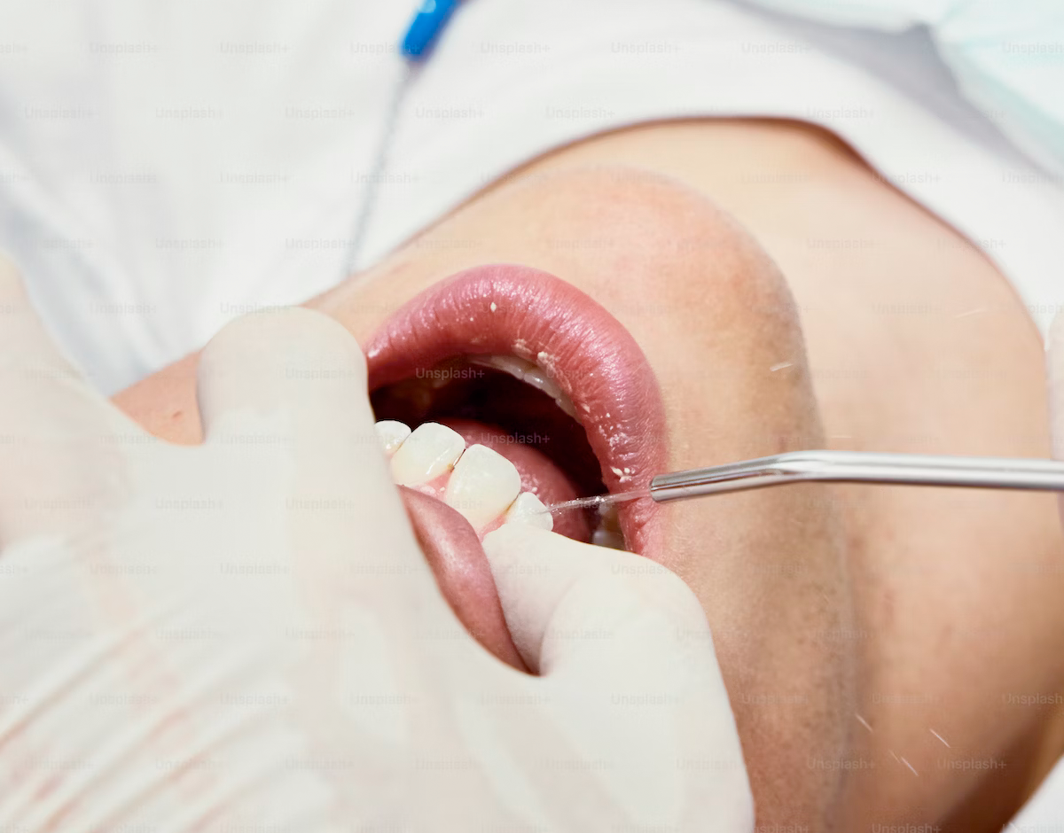 Лечение воспаленного зуба