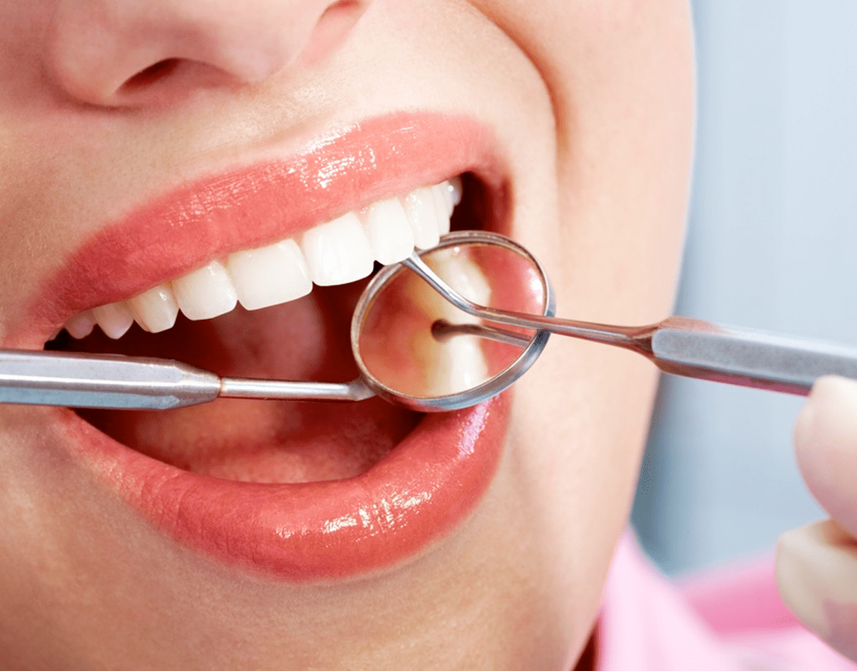 Лечение зубов. Кариес, пульпит, периодонтит